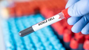 Sickle cell and beta thalassemia: what are the treatment options and challenges?